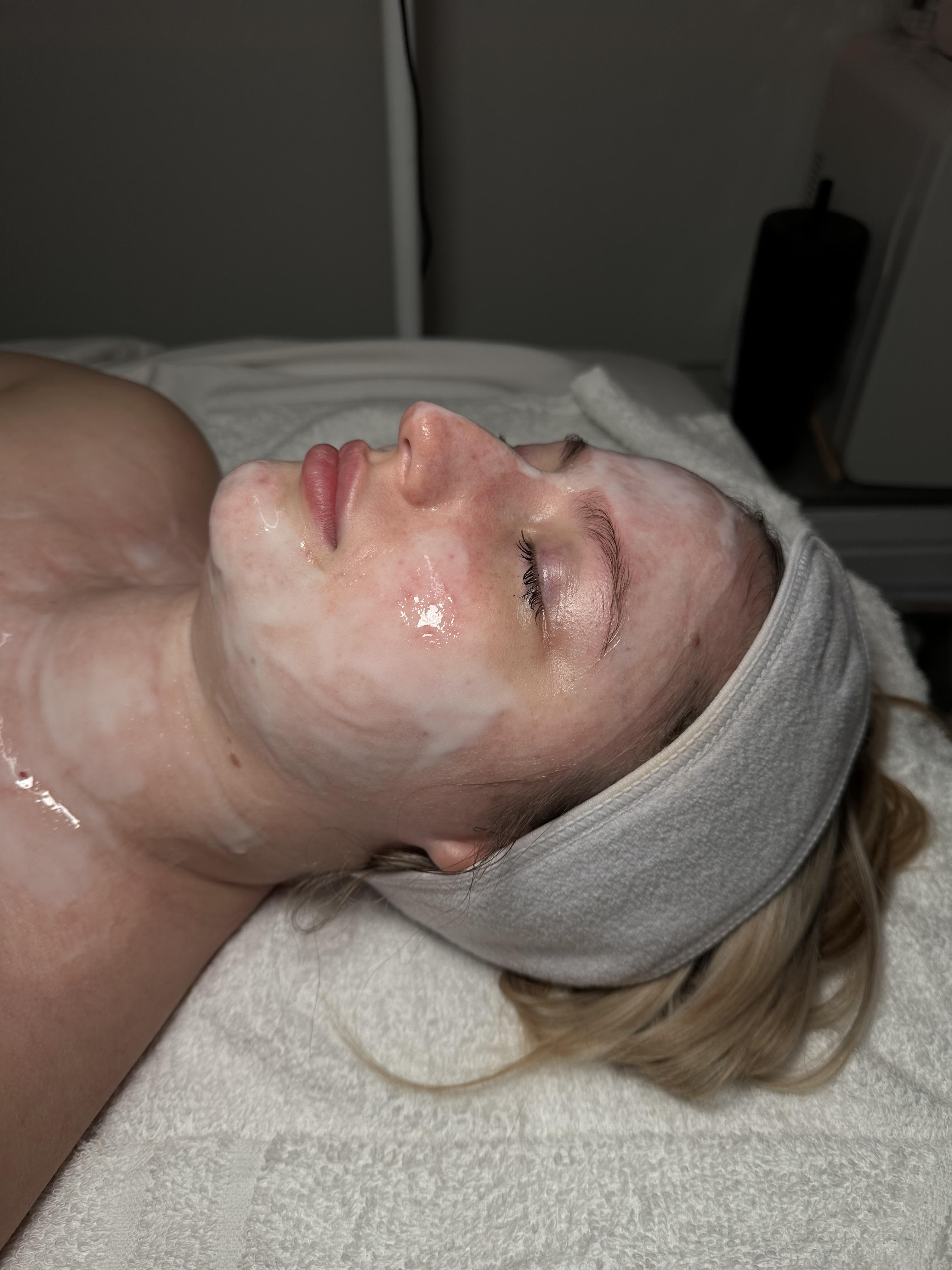 Custom facial treatment